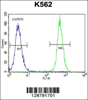 KRT25 Antibody (C-term)