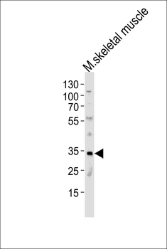 Mouse MOGT2 Antibody (C-term)