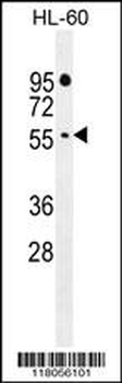 FBXW11 Antibody (Center)