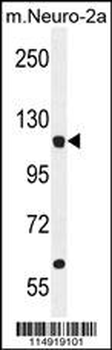 LARS Antibody (N-term)