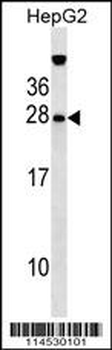 GFER Antibody (Center)