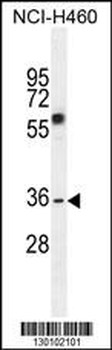 VSTM4 Antibody (Center)