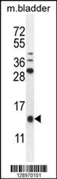 KTAP2 Antibody (C-term)