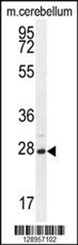 VSTM2A Antibody (Center)