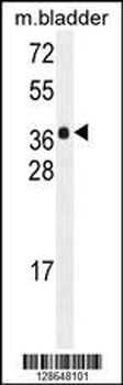 HARB1 Antibody (N-term)