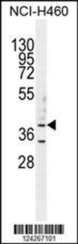 B3GALT5 Antibody (N-term)