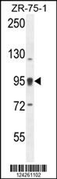 ACAP1 Antibody (N-term)