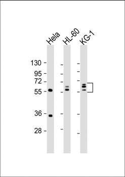 FGL2 Antibody (C-term)