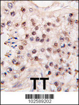 HDAC11 Antibody (C-term)