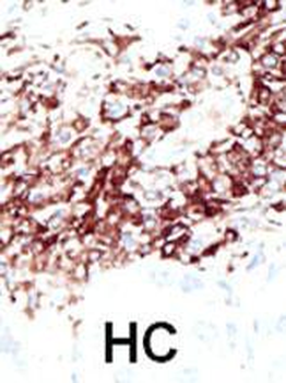 HDAC11 Antibody (N-term)