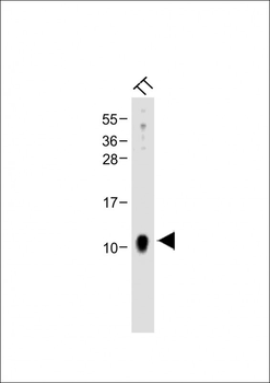 CALCA Antibody (Center)
