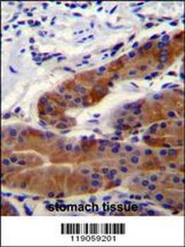 DFNB31 Antibody (Center)