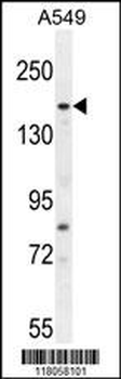 FGD6 Antibody (C-term)