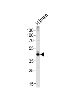 ALDOC Antibody (N-term)