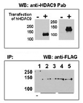HDAC9 Antibody (C-term)