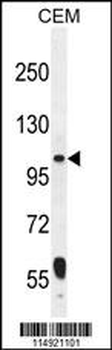 LARS2 Antibody (Center)