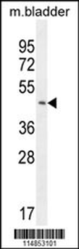 PARS2 Antibody (C-term)