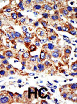 HDAC8 Antibody (N-term)