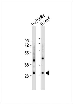 U119B Antibody (C-term)