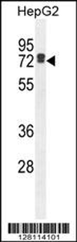 LRC40 Antibody (C-term)