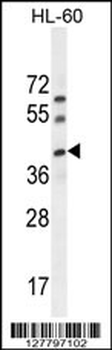 C17orf59 Antibody (Center)
