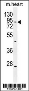 TBC14 Antibody (Center)