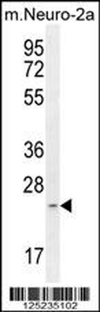 RT34 Antibody (N-term)