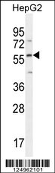 DMP4 Antibody (C-term)