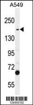 TDRD7 Antibody (C-term)