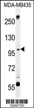 CA026 Antibody (N-term)