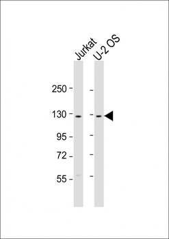 CENTG1 Antibody (C-term)