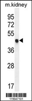 CDKN1C Antibody (N-term)