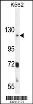 ATP8A2 Antibody (N-term)