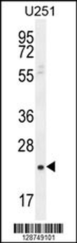 SIAH3 Antibody (C-term)
