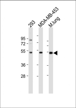 ENT1(Slc29a1) Antibody (S254)