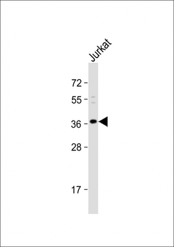 OR8B8 Antibody (C-term)