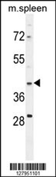 MAP1D Antibody (N-term)