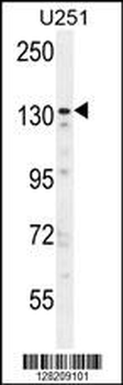 ZNF536 Antibody (N-term)