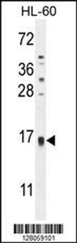 TCL6 Antibody (C-term)