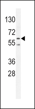 PRKAA2 (Thr172) Antibody (Center)