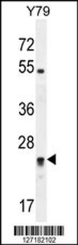 DPCD Antibody (Center)