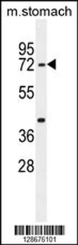 SRAC1 Antibody (C-term)