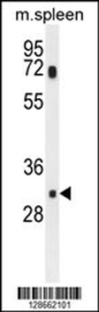 MCAR1 Antibody (N-term)