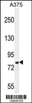 CB086 Antibody (C-term)