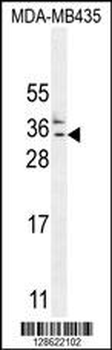 CK073 Antibody (N-term)