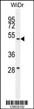 RT4I1 Antibody (C-term)