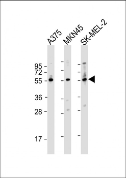 GSDMC Antibody (Center)