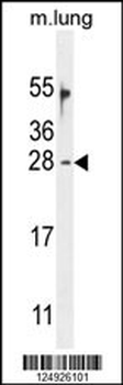 OAZ2 Antibody (C-term)