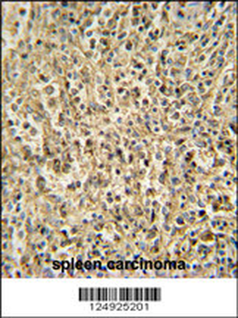 RNT2 Antibody (N-term)