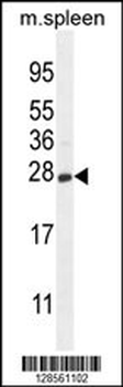 CRYGS Antibody (C-term)